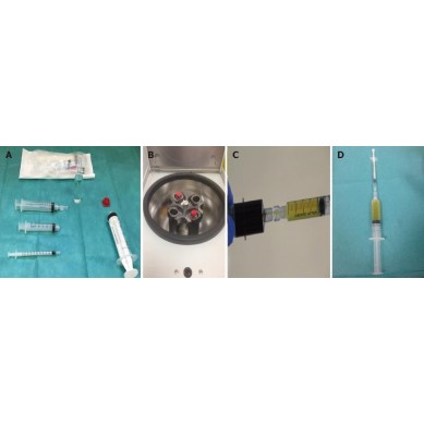 Kit PRP Cerrado Olin-1 | Extracción y obtención PRP
